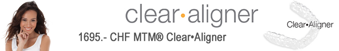 MTM Clear Aligners