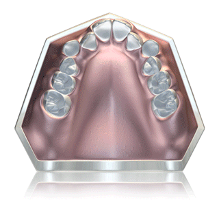 Teeth straightening naturally with the Myobrace system