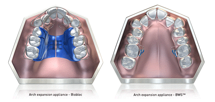 Teeth straightening naturally with the Myobrace system.