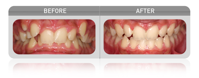 proven results - crowding case 02