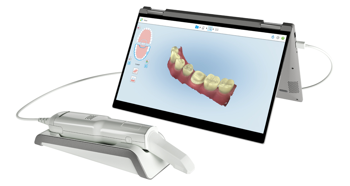 SCANSIONE 3D