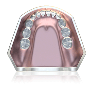 Removable myofunctional appliance treatment for children and adults -  Orthodontics